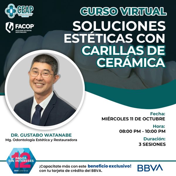 Soluciones Estéticas con Carillas de Cerámica