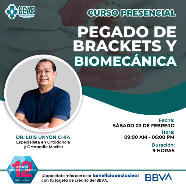 Presencial Pegado de Brackets y Biomecánica