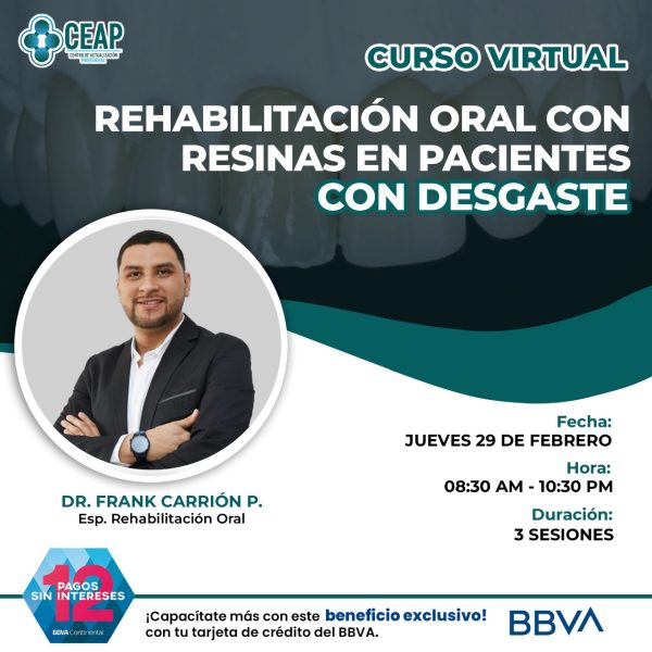 Curso Rehabilitación Oral con Resinas en Pacientes con Desgaste