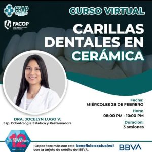 Curso Carillas Dentales en Cerámica