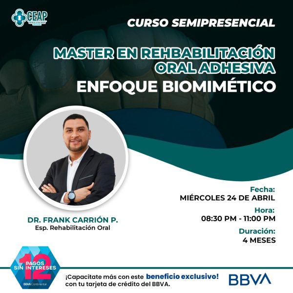Master en Rehabilitación Oral Adhesiva Full