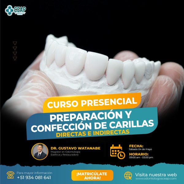 Curso Semipresencial Preparación y Confección de Carillas