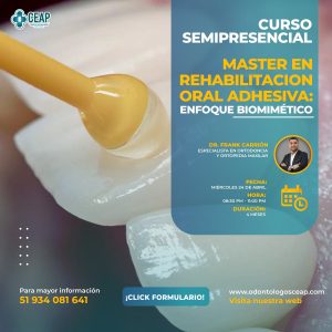 Master en Rehabilitación Oral Adhesiva