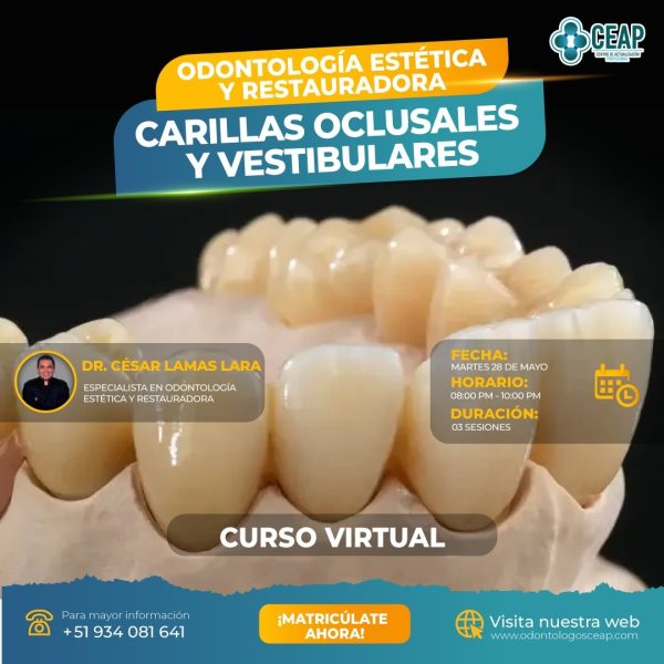 Curso Carillas Oclusales y Vestibulares