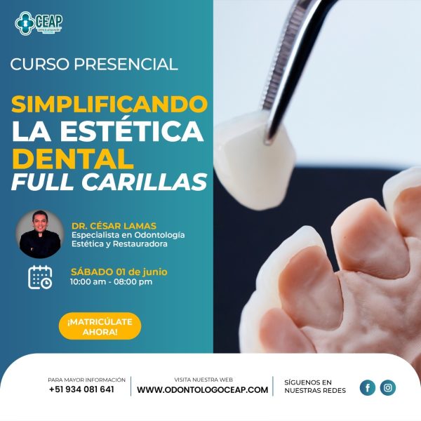 Curso simplificando la estética dental full carillas