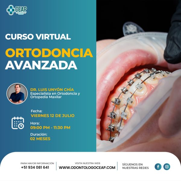 Curso Ortodoncia Virtual Avanzada