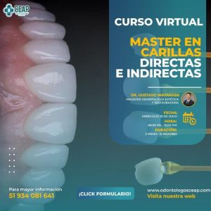 Curso Master en Carillas Directas e Indirectas 07.24