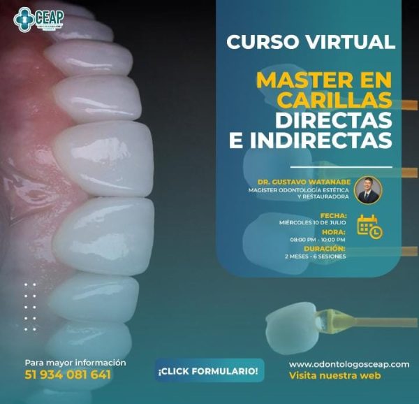 Curso Master en Carillas Directas e Indirectas 07.24
