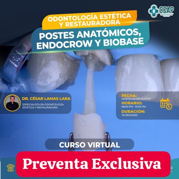 Postes anatómicos, endocrow y biobase