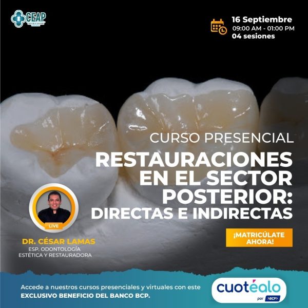 Curso Presencial Restauraciones en el Sector Posterior