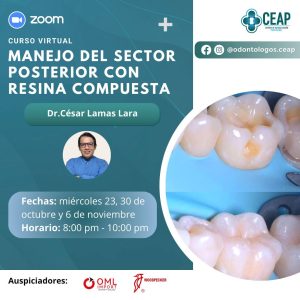 Curso Manejo del sector posterior con resina compuesta