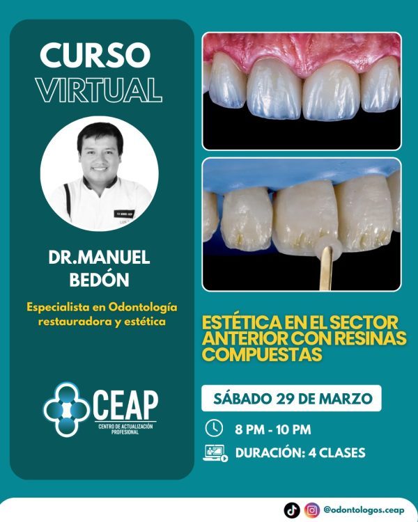 Curso Estética en el sector anterior con resinas compuestas