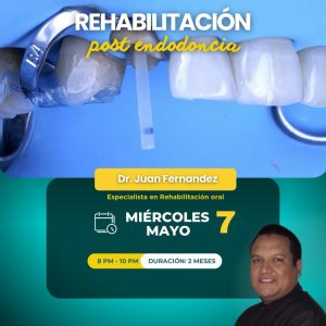 Curso Rehabilitación postendodontica