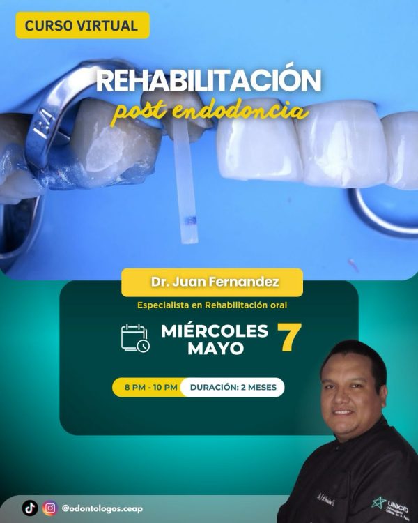 Curso Rehabilitación postendodontica