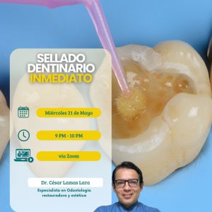 Conferencia sellado dentinario inmediato