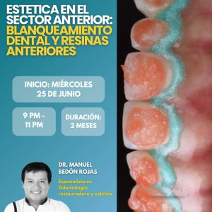 Estetica en el sector anterior