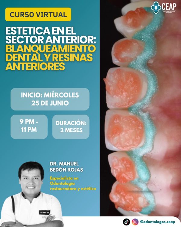 Estetica en el sector anterior
