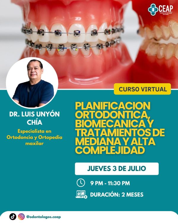 Planificación ortodóntica biomecánica y tratamientos de mediana y alta complejidad