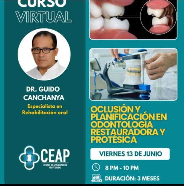 Curso Oclusion y Planificación 06.25