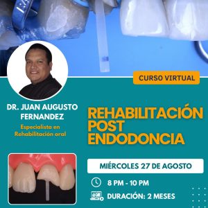 Curso Rehabilitacion Pos Endodoncia 08.25