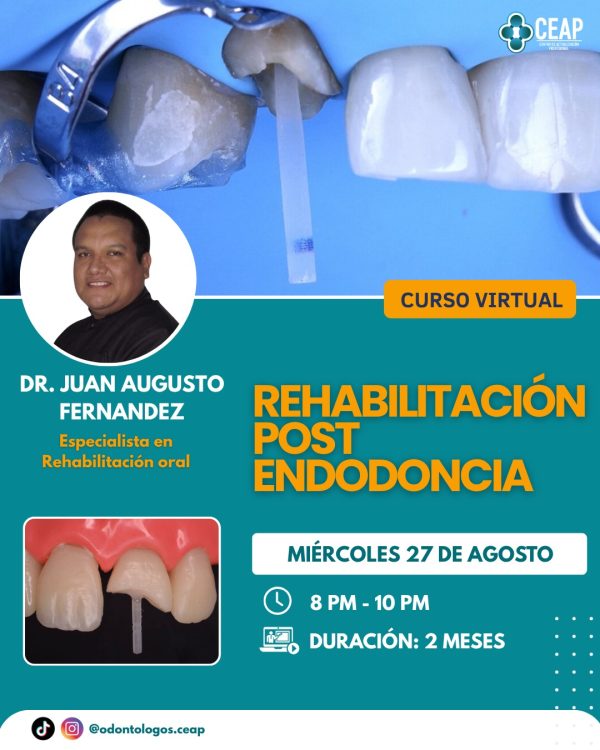 Curso Rehabilitacion Pos Endodoncia 08.25