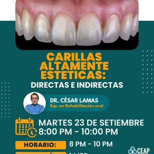 Curso carillas altamente esteticas: directas e indirectas