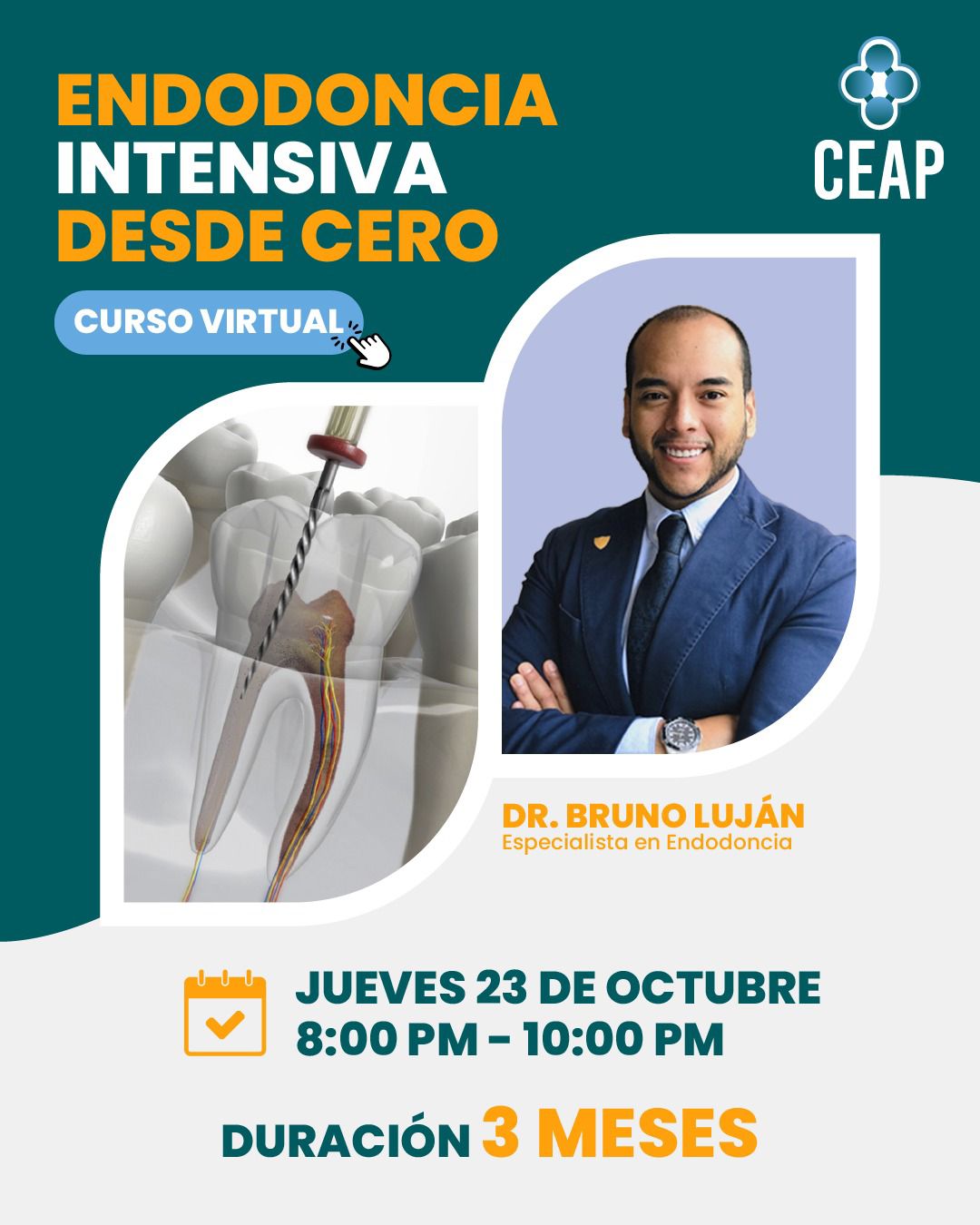 Curso Endodoncia Intensiva desde Cero 10.25
